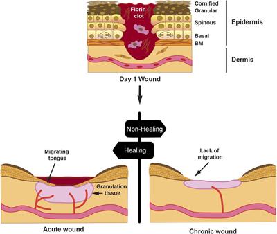 Chronic Wound Healing by Amniotic Membrane: TGF-β and EGF Signaling Modulation in Re-epithelialization